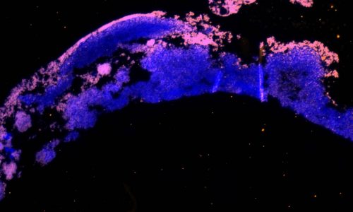 Biofilm Visualization and Quantification